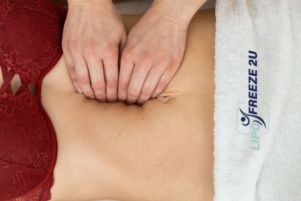 diastasis recti treatment Stowmarket
