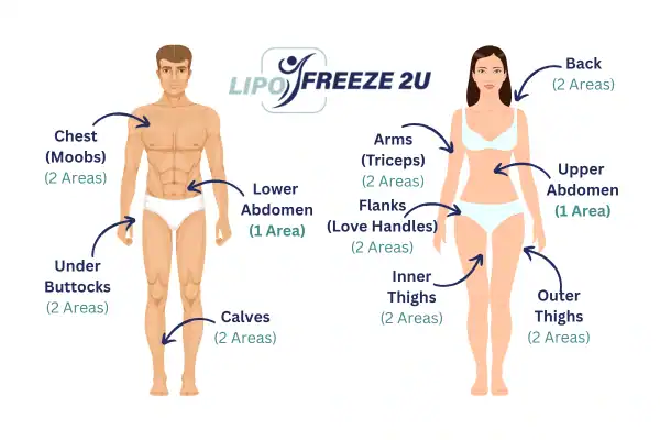 Areas you can have fat freezing treatment Stowmarket