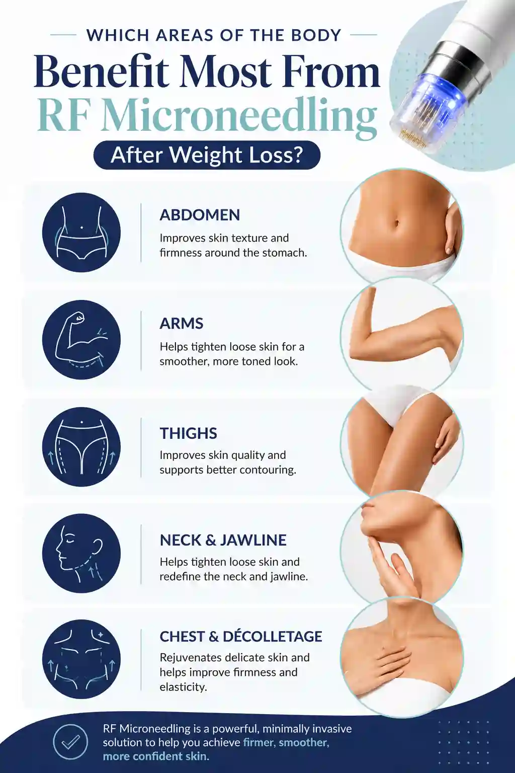 Which Areas of the Body Benefit Most From RF Microneedling After Weight Loss Stowmarket